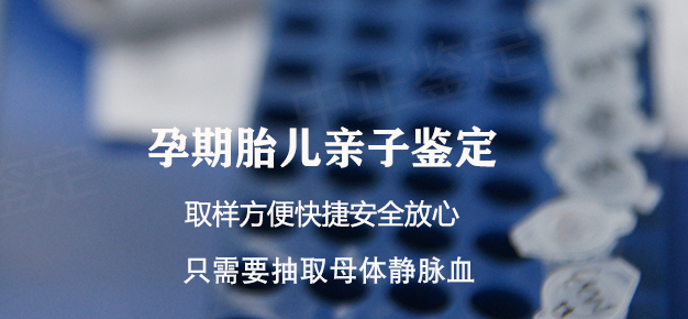 南京产前亲子鉴定正规机构在什么地方,南京怀孕亲子鉴定准确吗 南京产前亲子鉴定正规机构在什么地方,南京怀孕亲子鉴定准确吗